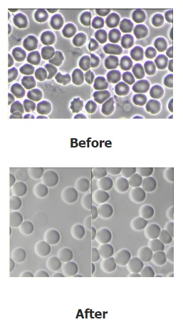 Blood Cell Analysis [after 30 days of drinking alkaline ionized water]