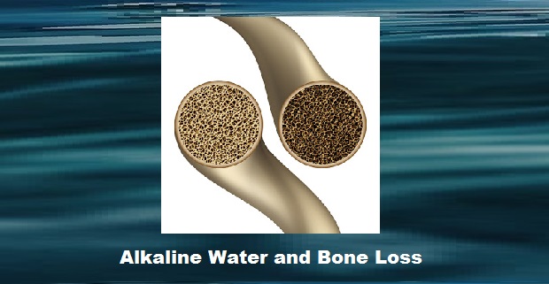 Alkaline Water and Bone Loss